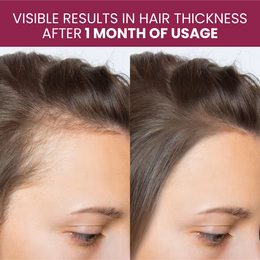 Vlado's Himalayan Organics Biotin 10000Mcg For Healthy Hair And Skin - 120 Tablets - Image 5