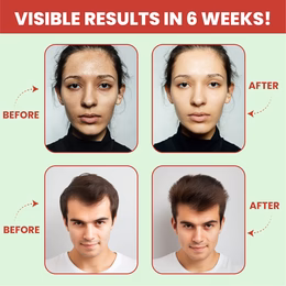 Vlado's Himalayan Organics Plant Based Vegan Collagen supplements - Healthy Skin, Hair & Nails - Skin Radiance - Clinically Proven - Reduce Pigmentation, Dark Spots & Brighten Skin Tone - Supplement for Women - 100 Grams ( Watermelon Flavor ) - Image 5